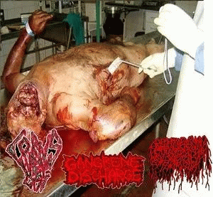 Gangrene Discharge : Gangrene Discharge - Corpus Luteum Cyst - Gangrenophagia